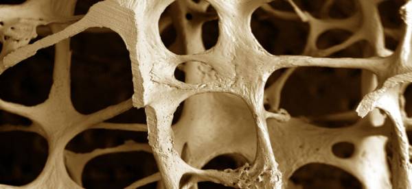 Ομιλία για την οστεοπόρωση στο Β' ΚΑΠΗ Καλαμάτας