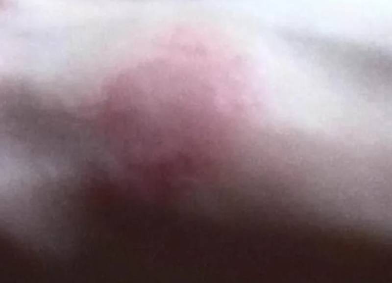 Challenge με αποσμητικά: Η νέα επικίνδυνη τάση στο TikTok που στέλνει παιδιά στα νοσοκομεία