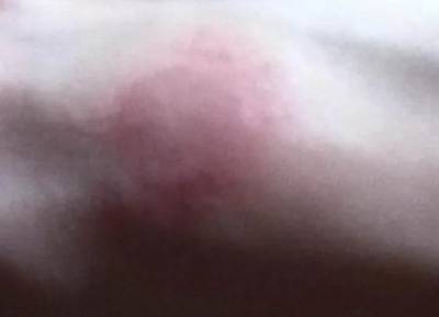 Challenge με αποσμητικά: Η νέα επικίνδυνη τάση στο TikTok που στέλνει παιδιά στα νοσοκομεία