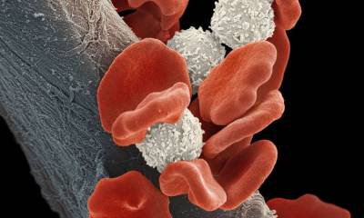 Βρετανοί γιατροί παρουσίασαν πρωτοπόρα θεραπεία κατά μορφής λευχαιμίας