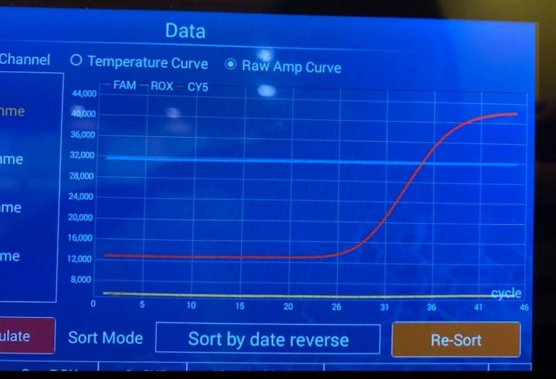 Ομιλος Εργαστηρίων "ANALYSIS": Αλεξάνδρα Μαστρογιαννάκη-Μαρίνη &amp; Πέτρος Σιψάς - Εργαστηριακοί Ιατροί Μικροβιολόγοι-Βιοπαθολόγοι, Εδρα: Κυπαρισσία