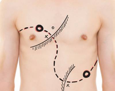 Παπαλεξίου και Πλιός στην περφόρμανς "Τρωάδες - Anima Captus"