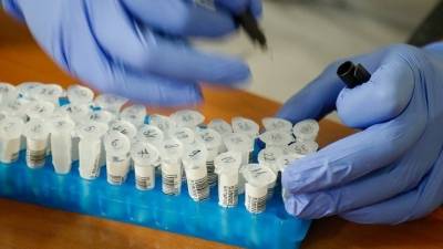 Kορονοϊός: 390 κρούσματα, 421 διασωληνωμένοι, 36 θάνατοι το τελευταίο 24ωρο στην Ελλάδα