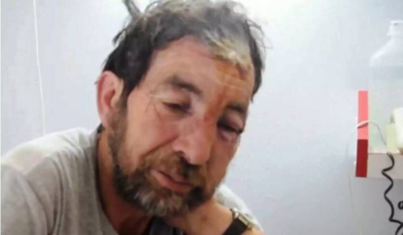 Βοσκός δέχθηκε επίθεση από αρκούδα στη Φθιώτιδα