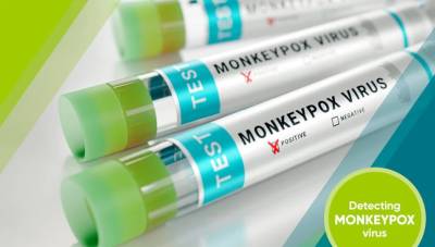 Ευλογιά των Πιθήκων: Ο αριθμός των θυμάτων θα αυξηθεί, εκτιμά ο ΠΟΥ