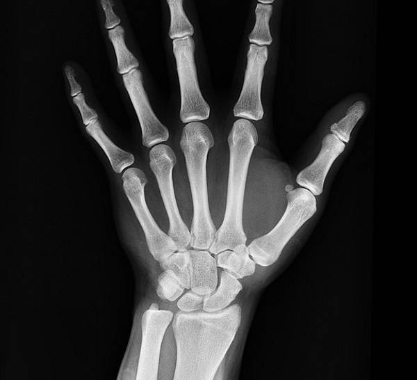 Ακτινογραφία μιας ασθενικής οικονομίας