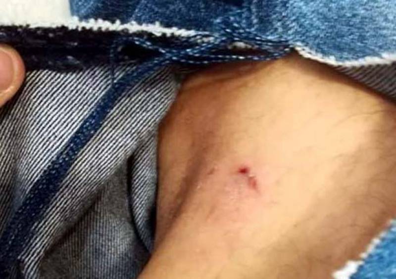 Καλαμάτα: Αδέσποτα σκυλιά επιτέθηκαν σε εργαζόμενο φοιτητή