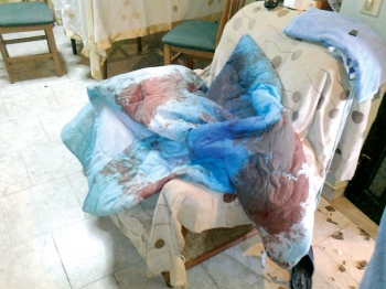 Λήστεψαν βενζινοπώλη στο Κορυφάσιο χτυπώντας τον με κάβουρα