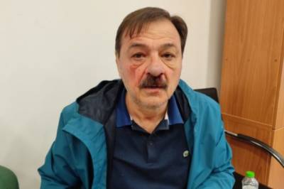 Βόλος: Ξυλοδαρμός σε Δ.Σ. από “μασκοφόρο” δημοτικό σύμβουλο του Μπέου