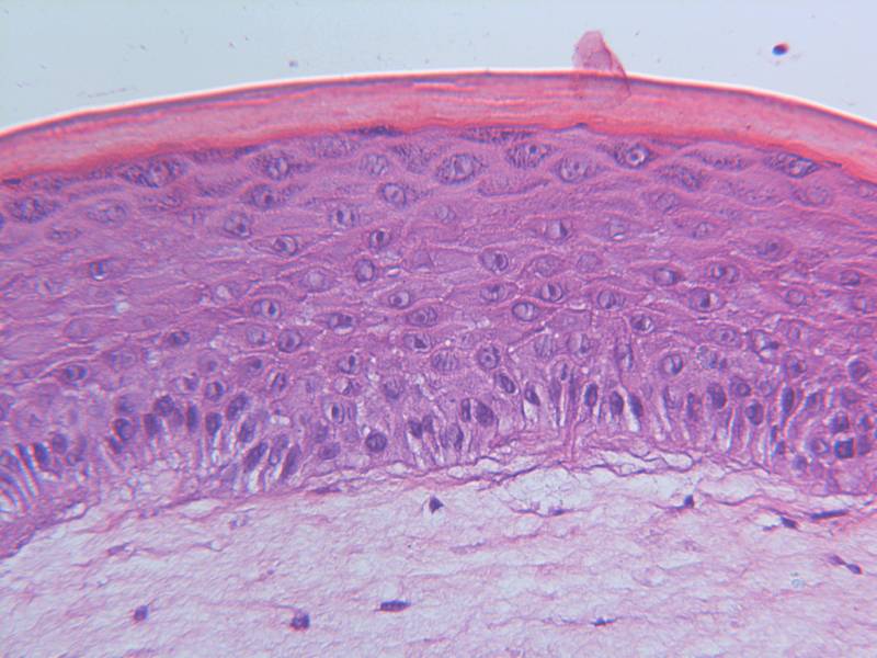 Μελέτη: Το τεχνητό ανθρώπινο δέρμα ανοίγει το δρόμο για νέες θεραπείες για τον καρκίνο του δέρματος