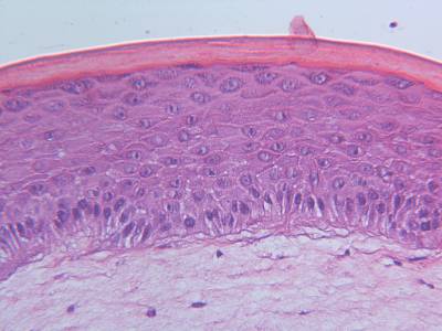 Μελέτη: Το τεχνητό ανθρώπινο δέρμα ανοίγει το δρόμο για νέες θεραπείες για τον καρκίνο του δέρματος