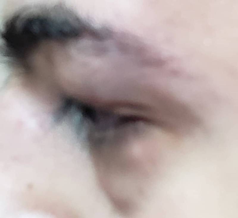 Καλαμάτα: Μέλη της Νεολαίας ΣΥΡΙΖΑ δέχθηκαν επίθεση, ενώ κολλούσαν αφίσες!