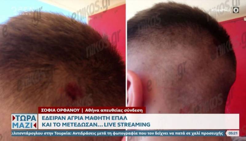 Χτύπησαν με κατσαβίδι μαθητή σε ΕΠΑΛ στο Περιστέρι - Μετέδωσαν τον ξυλοδαρμό σε live streaming (Βίντεο)