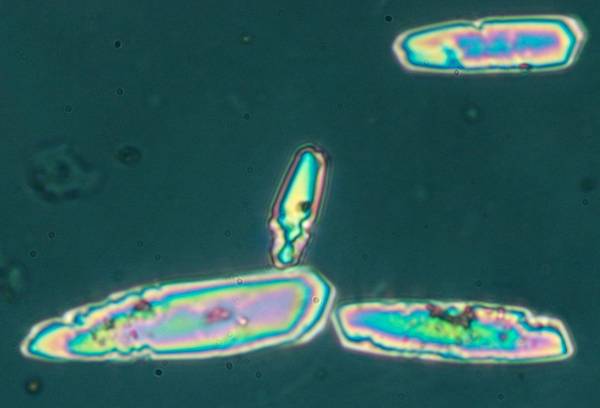 Κέντρο Μελέτης Ιστορίας Αρχαίας Θουρίας: Οι φυτόλιθοι της Αρχαίας Θουρίας