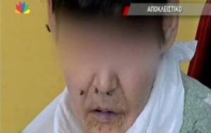 Star στο ΚΕΦΙΑΠ Φιλιατρών: Τριτοκοσμικές εικόνες και κραυγές απελπισίας