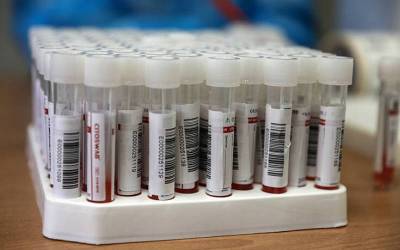 Η γεωγραφική κατανομή των κρουσμάτων κορονοϊού το τελευταίο 24ωρο - 27 νέα κρούσματα στη Μεσσηνία