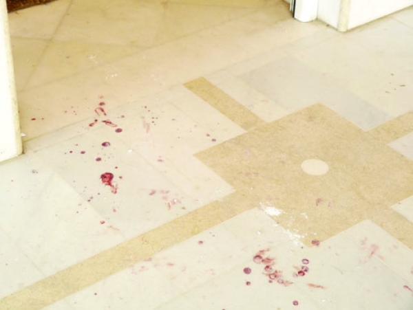 Το DNA θα δείξει τους δράστες της συμπλοκής