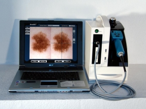 Παραδίδεται σήμερα το σύστημα δερματοσκόπησης στο Νοσοκομείο Καλαμάτας