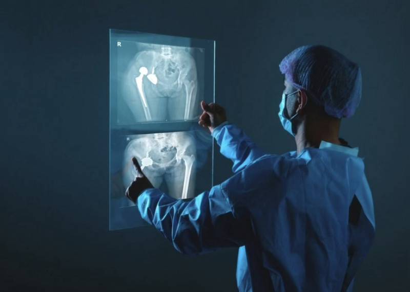 Ρομποτική και Κλασική Ολική Αρθροπλαστική Ισχίου: Ποια Μέθοδος είναι Κατάλληλη για Εσάς;