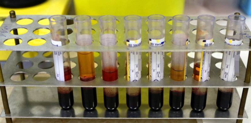 Έρχονται τεστ ταχείας διάγνωσης κορονοϊού στο Νοσοκομείο Καλαμάτας