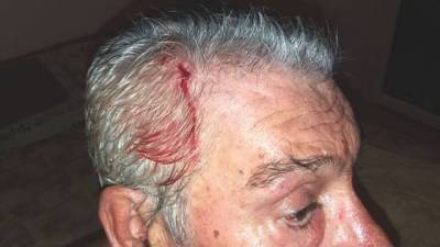 4 κουκουλοφόροι λήστεψαν εστιάτορα της Φοινικούντας στη Λαχανάδα