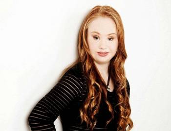 Το 18χρονο μοντέλο με σύνδρομο Ντάουν, που θέλει να αλλάξει τον κόσμο