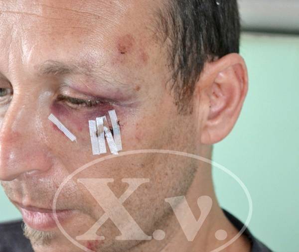 Ο Ιατρικός Σύλλογος Καλαμάτας καταγγέλλει την επίθεση στον Μακρέα