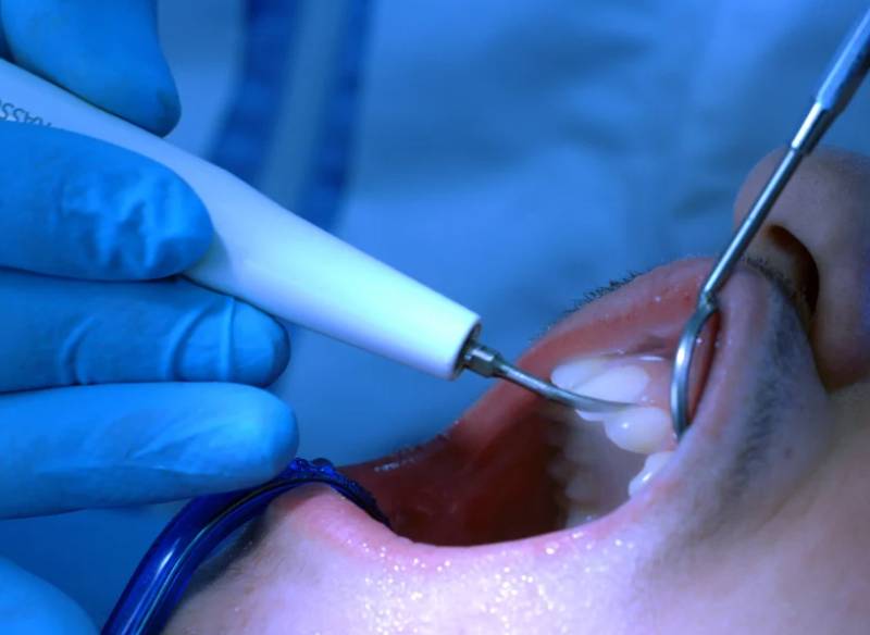 Dentist Pass: Πώς θα πάρετε voucher για φθορίωση δοντιών