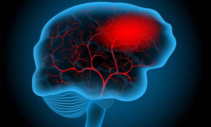 Αυξημένος ο κίνδυνος εγκεφαλικού για τους ανθρώπους με συμπτώματα κατάθλιψης