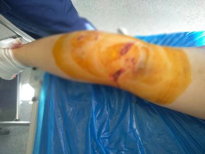 Η Λαϊκή Συσπείρωση Καλαμάτας για την επίθεση αδέσποτων σε εργαζόμενη γυναίκα