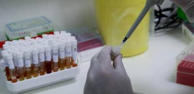 Ιατρικός Σύλλογος Μεσσηνίας: “Στήριξη στις κινητοποιήσεις των μικροβιολόγων”